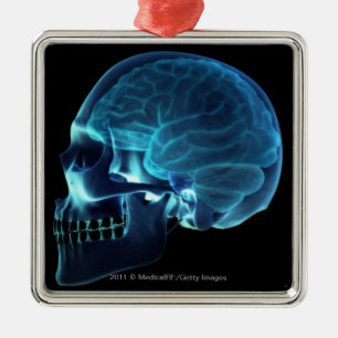 X-ray of the brain inside a skull metal tree decoration