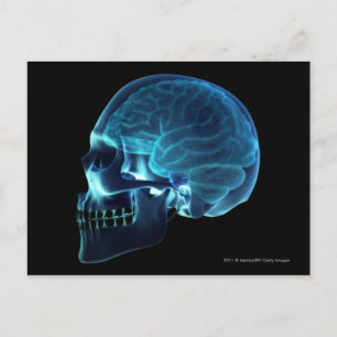 X-ray of the brain inside a skull postcard