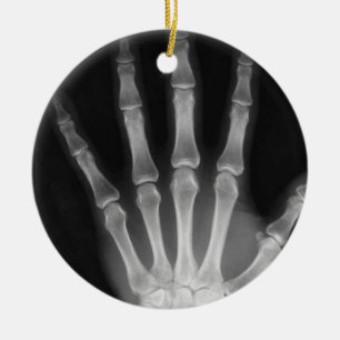 X-RAY SKELETON HAND FINGERS B&W CERAMIC TREE DECORATION