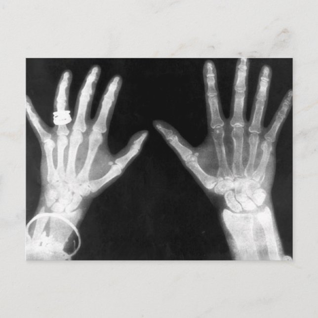 X-Ray Skeleton Hands & Jewellery - B&W Postcard (Front)