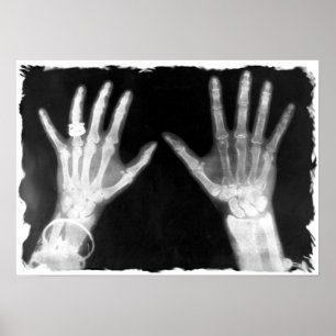 X-Ray Skeleton Hands & Jewellery - B&W Poster
