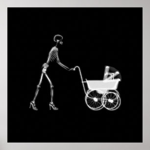 X-Ray Skeleton Mum & Baby - Original B&W Poster