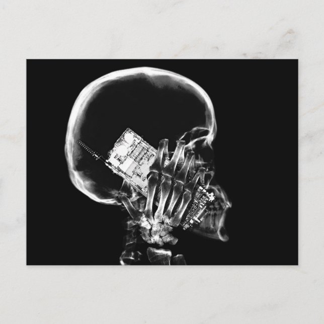 X-RAY SKELETON ON CELL PHONE BLACK & WHITE POSTCARD (Front)