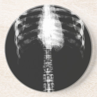 X-RAY SKELETON TORSO RIBS - B&W COASTER
