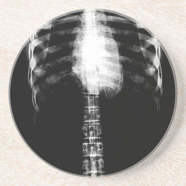 X-RAY SKELETON TORSO RIBS - B&W COASTER (Front)