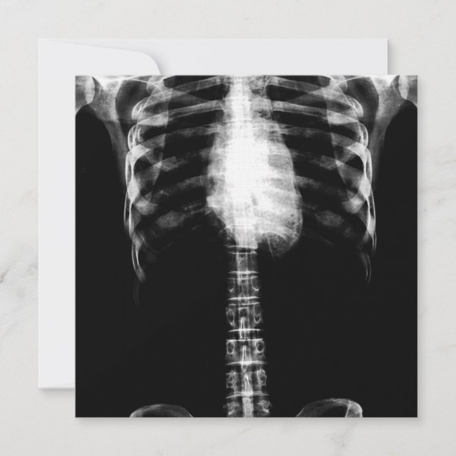 X-RAY SKELETON TORSO RIBS - B&W INVITATION (Front)