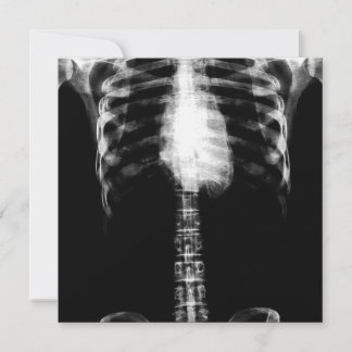 X-RAY SKELETON TORSO RIBS - B&W INVITATION
