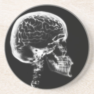 X-RAY SKULL BRAIN - BLACK & WHITE COASTER
