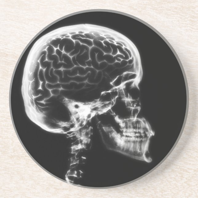 X-RAY SKULL BRAIN - BLACK & WHITE COASTER (Front)