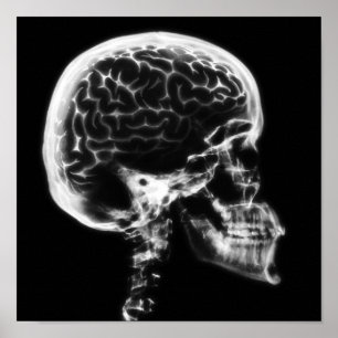 X-RAY SKULL BRAIN - BLACK & WHITE POSTER