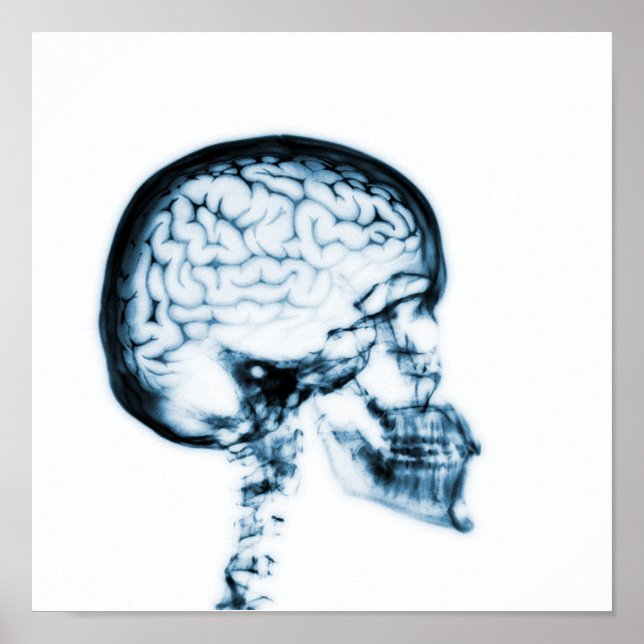 X-RAY SKULL BRAIN - BLUE POSTER (Front)