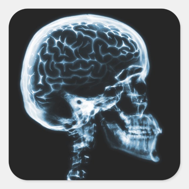 X-RAY SKULL BRAIN - BLUE SQUARE STICKER (Front)