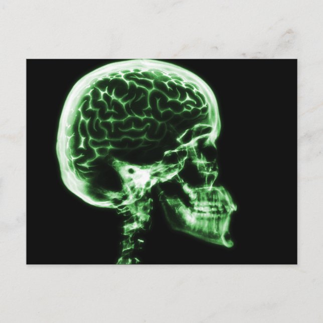 X-RAY SKULL BRAIN - GREEN POSTCARD (Front)