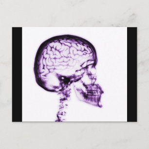 X-RAY SKULL BRAIN - PURPLE POSTCARD