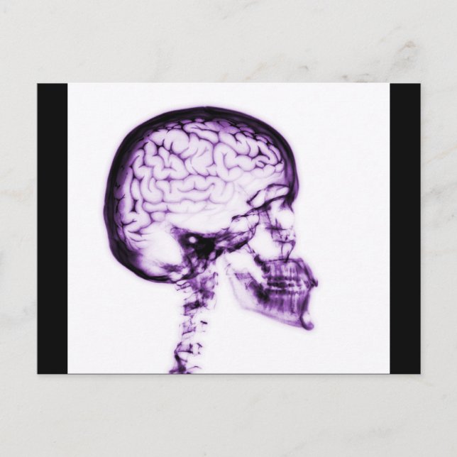 X-RAY SKULL BRAIN - PURPLE POSTCARD (Front)