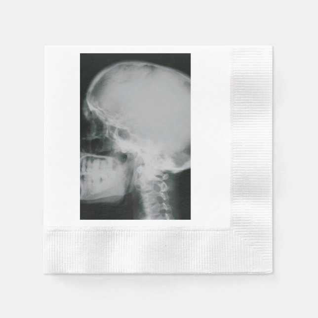 X-Ray Skull Napkin (Front)