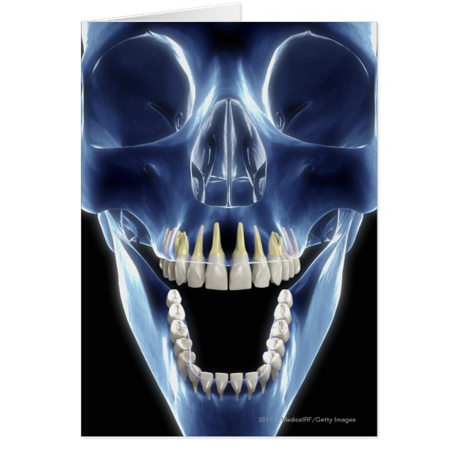X-ray style look at human teeth (Front)