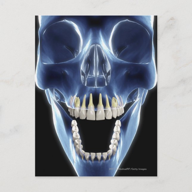 X-ray style look at human teeth postcard (Front)