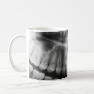 X-Ray Teeth Mouth Smile Black and White Coffee Mug