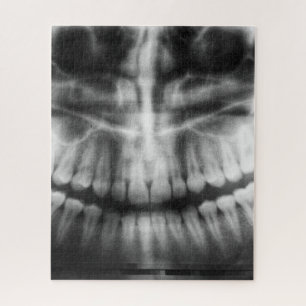X-Ray Teeth Mouth Smile Black and White Jigsaw Puzzle