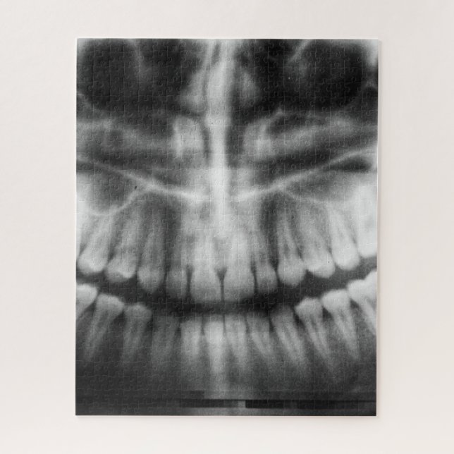 X-Ray Teeth Mouth Smile Black and White Jigsaw Puzzle (Vertical)