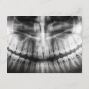 X-Ray Teeth Mouth Smile Black and White Postcard