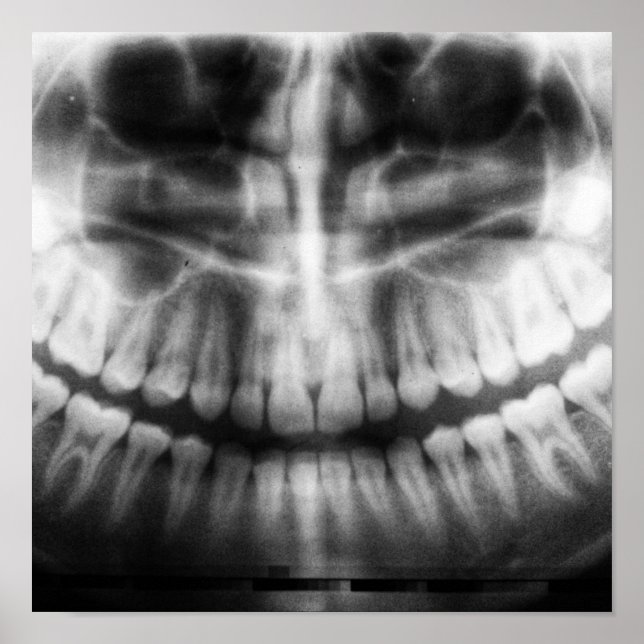 X-Ray Teeth Mouth Smile Black and White Poster (Front)