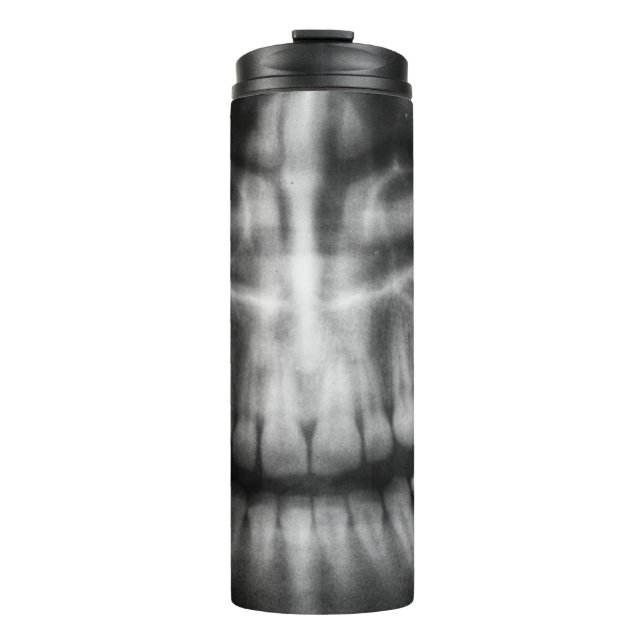 X-Ray Teeth Mouth Smile Black and White Thermal Tumbler (Front)