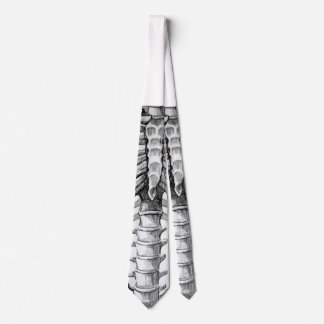 X-ray tie