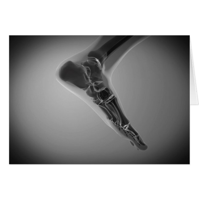 X-Ray View Of Human Foot 4 (Front Horizontal)