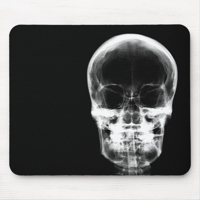 X-RAY VISION SKELETON SKULL - B&W MOUSE PAD (Front)