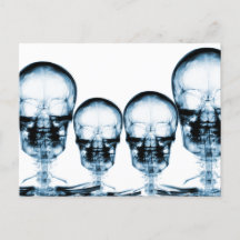X-Ray Vision Skeleton Skull - Blue