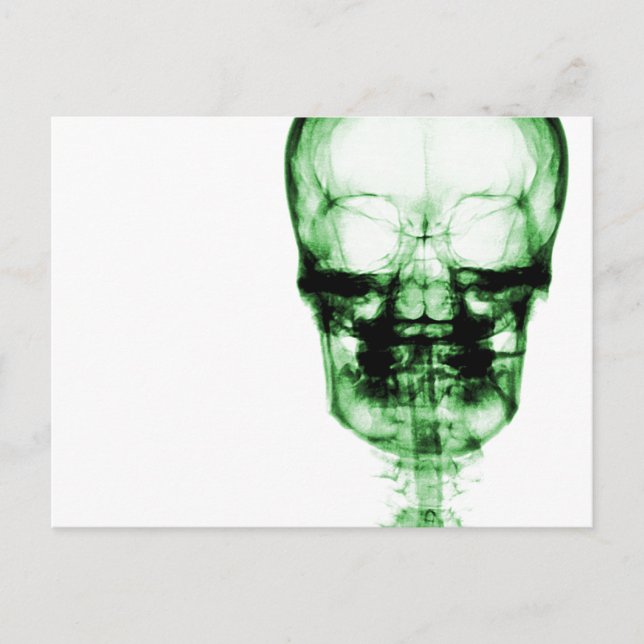 X-Ray Vision Skeleton Skull - Green Postcard (Front)