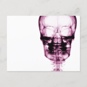 X-Ray Vision Skeleton Skull - Pink Postcard