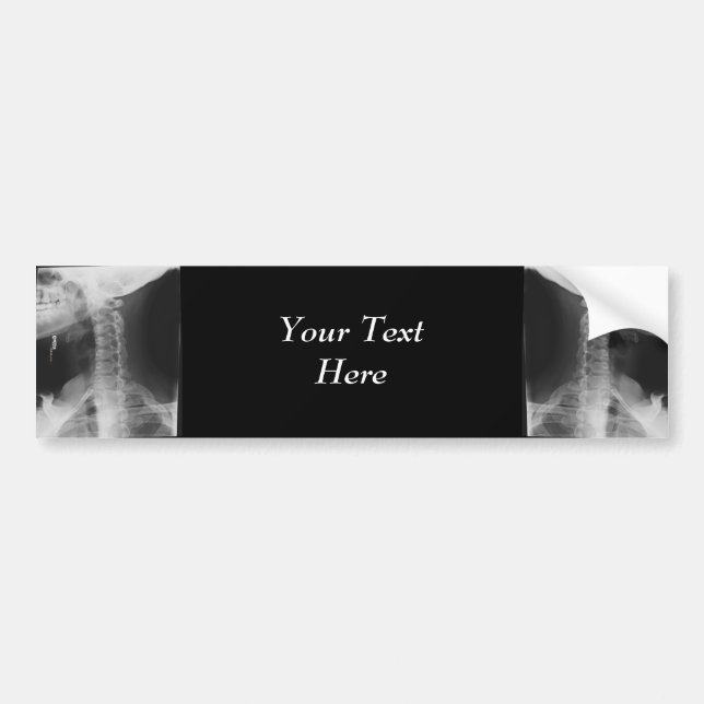 X-rayed 2 bumper sticker (Front)