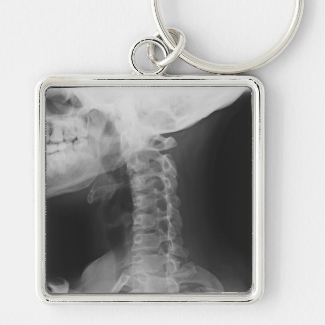 X-rayed 2 key ring (Front)
