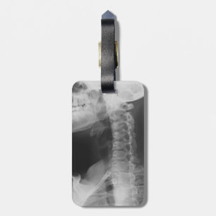X-rayed 2 luggage tag