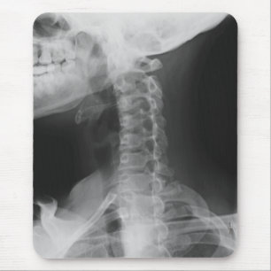 X-rayed 2 mouse pad