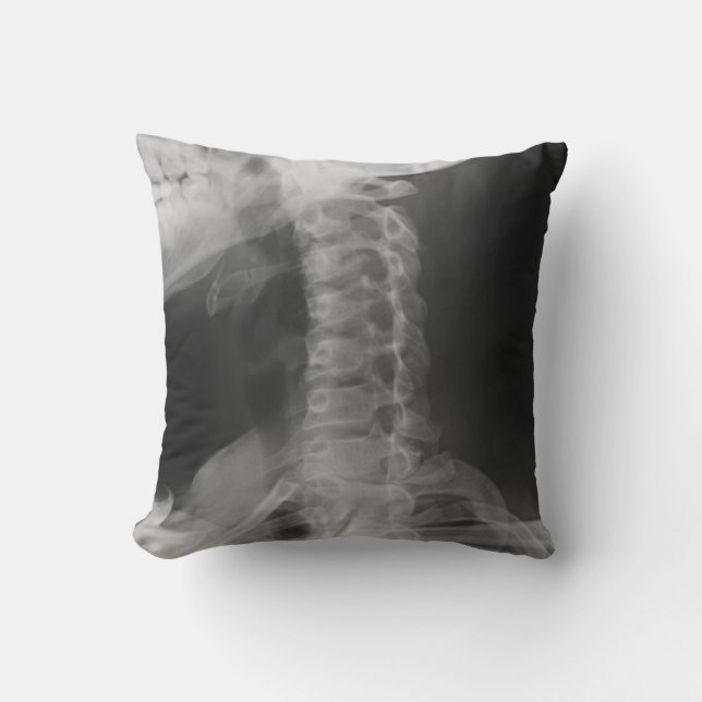 X-Rayed 2 (Original) Cushion (Front)