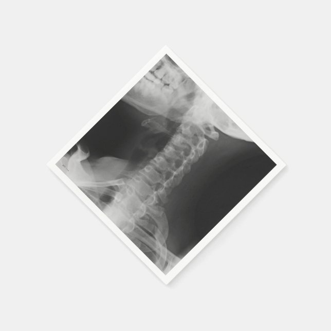 X-Rayed 2 (Original) Napkin (Corner)