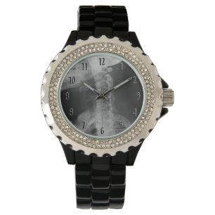 X-rayed 2 (Original) Watch