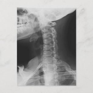 X-rayed 2 postcard