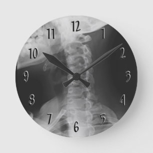 X-rayed 2 round clock