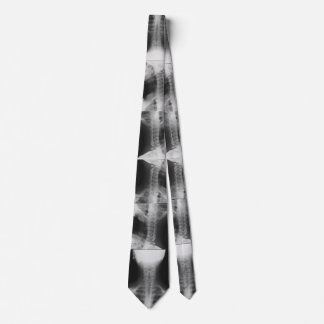 X-rayed 2 tie