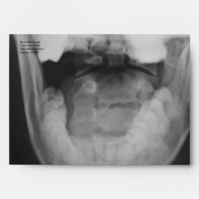 X-rayed 3 envelopes (Front)