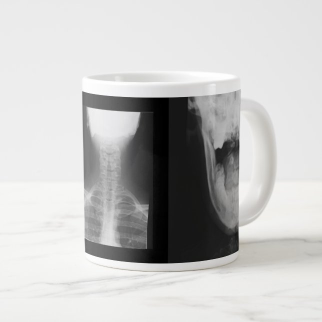 X-rayed 3 large coffee mug (Front Right)