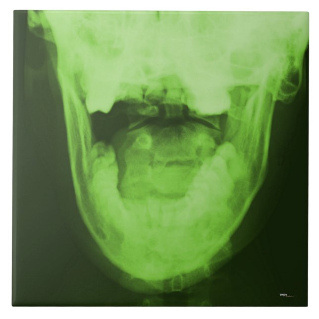X-rayed 3 - Radioactive Green Ceramic Tile (Front)
