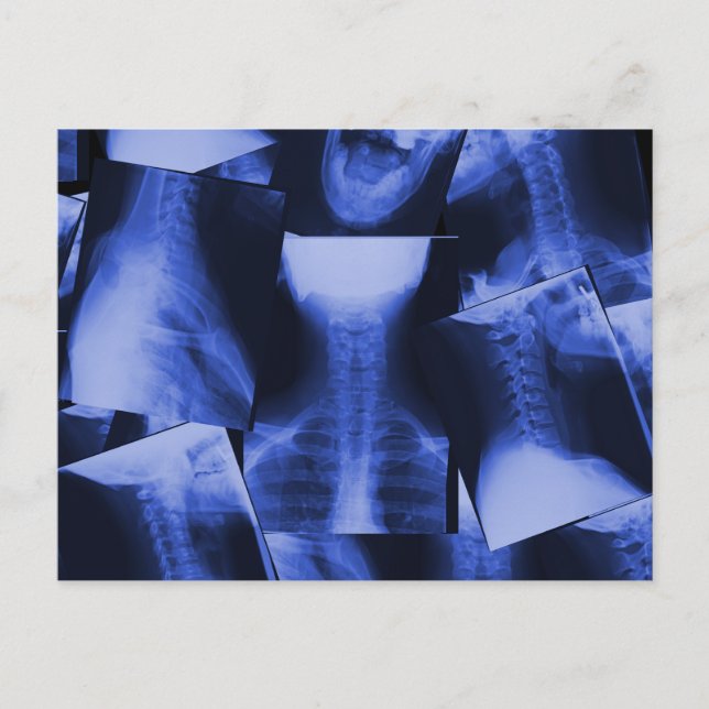 X-rayed - Electromagnetic Blue Postcard (Front)