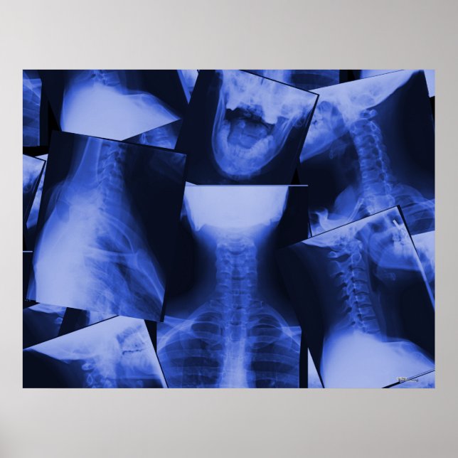 X-rayed - Electromagnetic Blue Poster (Front)