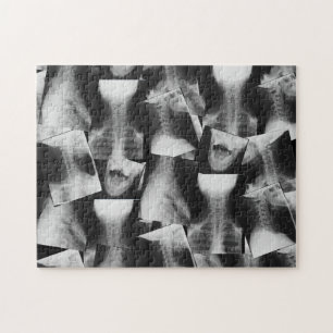 X-Rayed (Original) Jigsaw Puzzle